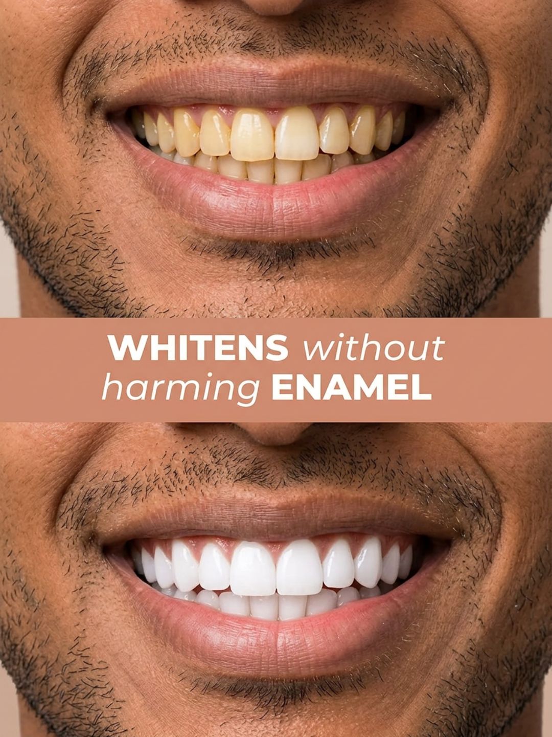 Better Bright Cinnamon Mint 5% HAp + n-HA Sensitivity Care Toothpaste, Fluoride-Free, 2 x 100g